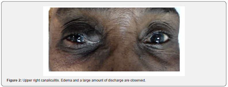 Click here to view Large Figure 2