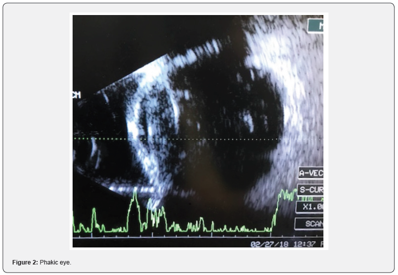 Click here to view Large Figure 2