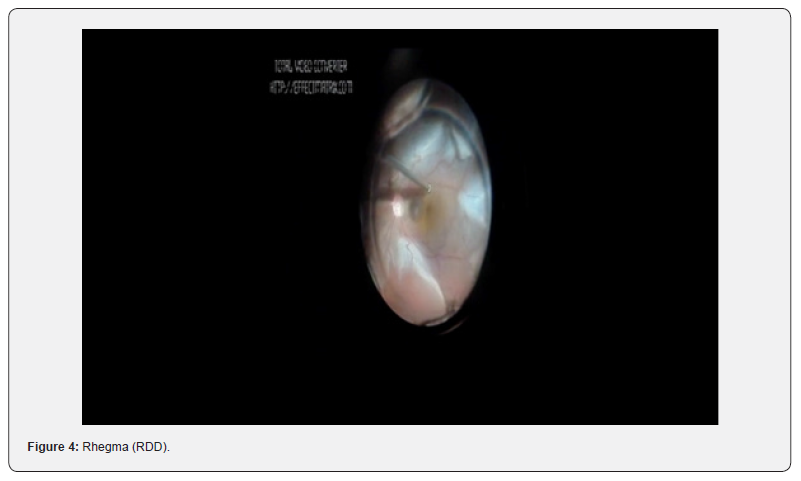 Click here to view Large Figure 4