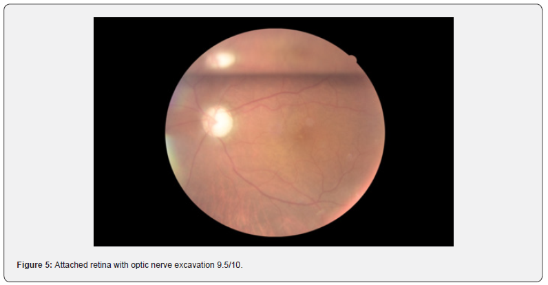 Click here to view Large Figure 5