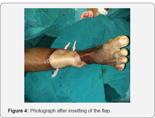 Click here to view Large Figure 4