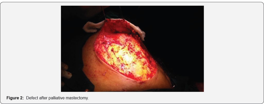 Click here to view Large Figure 2