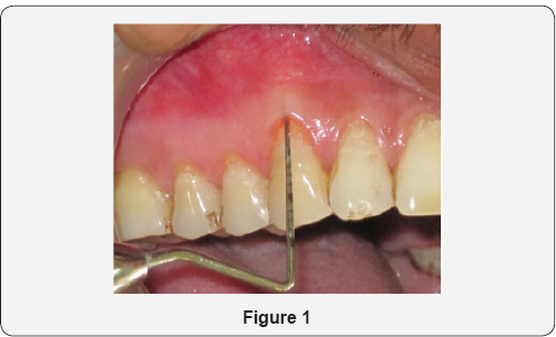 Click here to view Large Figure 1