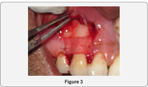 Click here to view Large Figure 3