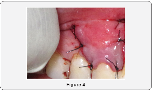 Click here to view Large Figure 4