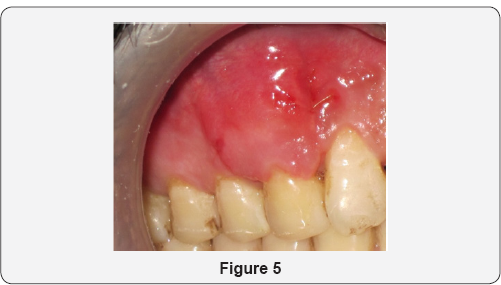 Click here to view Large Figure 5