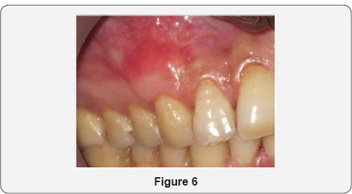 Click here to view Large Figure 6
