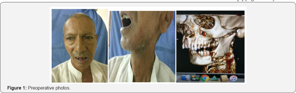 Click here to view Large Figure 1