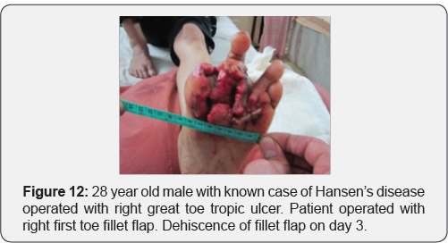 Click here to view Large Figure 12