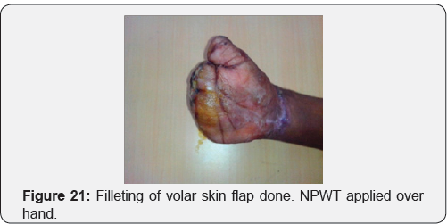 Click here to view Large Figure 21