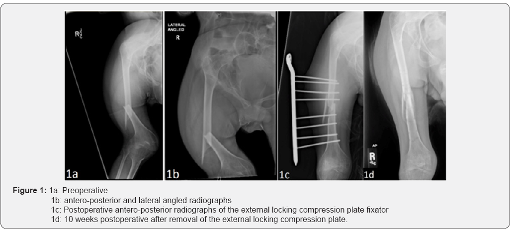 Click here to view Large Figure 1