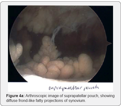 Click here to view Large Figure 4