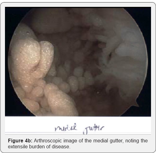 Click here to view Large Figure 4