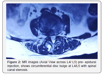 Click here to view Large Figure 2 Juniper Online Journal of Orthopedic & Orthoplastic Surgery