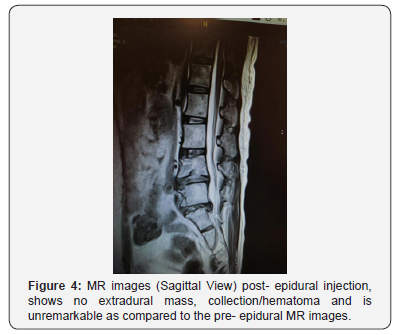Click here to view Large Figure 4 Juniper Online Journal of Orthopedic & Orthoplastic Surgery