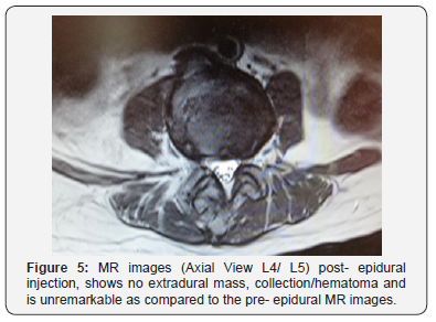 Click here to view Large Figure 5 Juniper Online Journal of Orthopedic & Orthoplastic Surgery