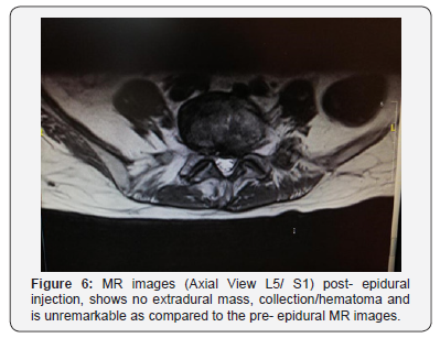 Click here to view Large Figure 6 Juniper Online Journal of Orthopedic & Orthoplastic Surgery