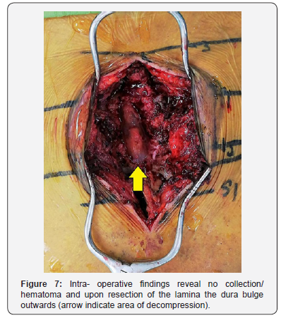 Click here to view Large Figure 7 Juniper Online Journal of Orthopedic & Orthoplastic Surgery