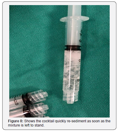 Click here to view Large Figure 8 Juniper Online Journal of Orthopedic & Orthoplastic Surgery