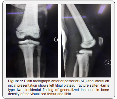 Click here to view Large Figure 1 Juniper Online Journal of Orthopedic & Orthoplastic Surgery