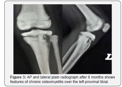 Click here to view Large Figure 3 Juniper Online Journal of Orthopedic & Orthoplastic Surgery