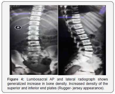Click here to view Large Figure 4 Juniper Online Journal of Orthopedic & Orthoplastic Surgery