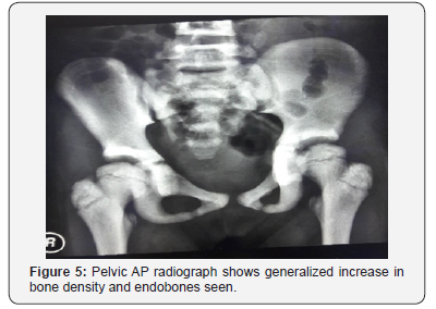 Click here to view Large Figure 5 Juniper Online Journal of Orthopedic & Orthoplastic Surgery