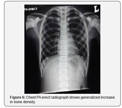 Click here to view Large Figure 6 Juniper Online Journal of Orthopedic & Orthoplastic Surgery