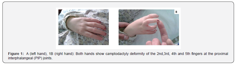 Click here to view Large Figure 1 Juniper Online Journal of Orthopedic & Orthoplastic Surgery