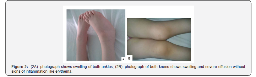 Click here to view Large Figure 2 Juniper Online Journal of Orthopedic & Orthoplastic Surgery