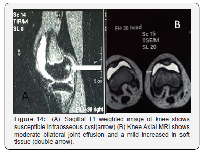 Click here to view Large Figure 14 Juniper Online Journal of Orthopedic & Orthoplastic Surgery