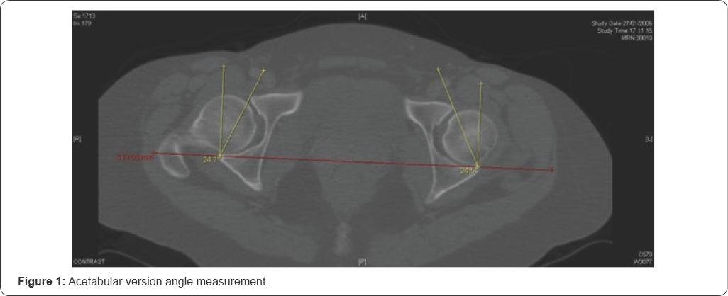 Click here to view Large Figure 1