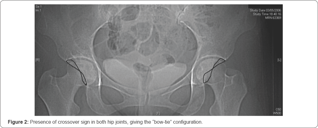 Click here to view Large Figure 2