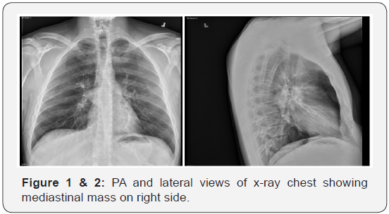 Click here to view Large Figure 1