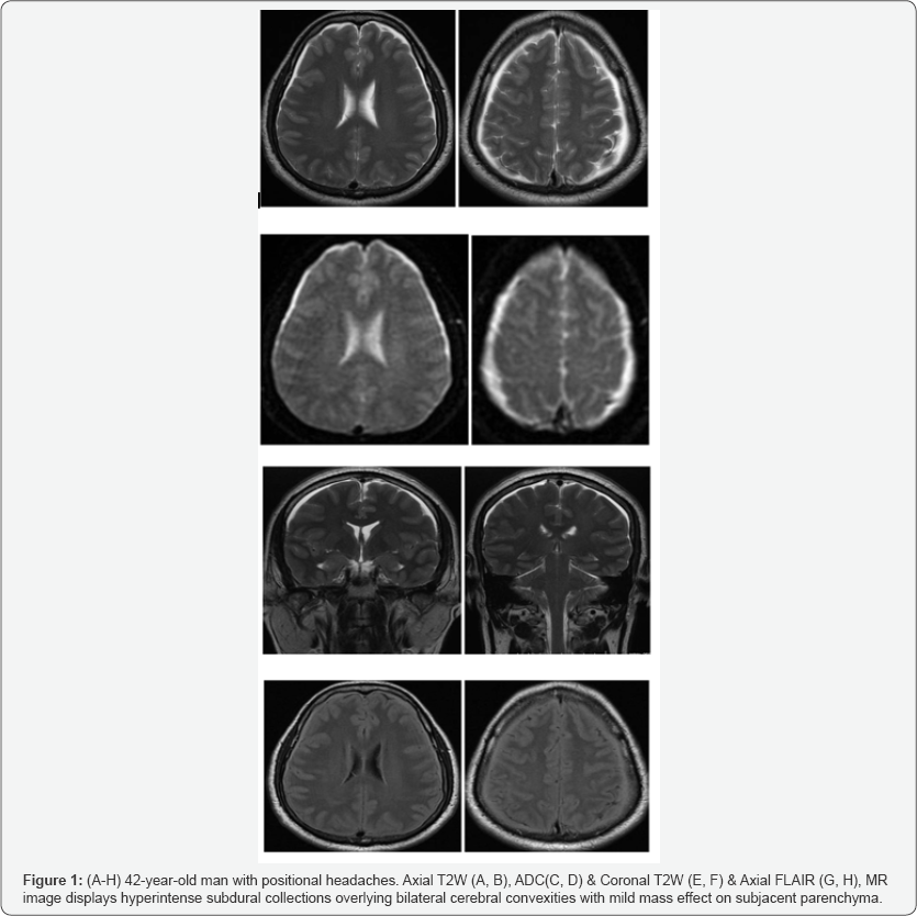 Click here to view Large Figure 1