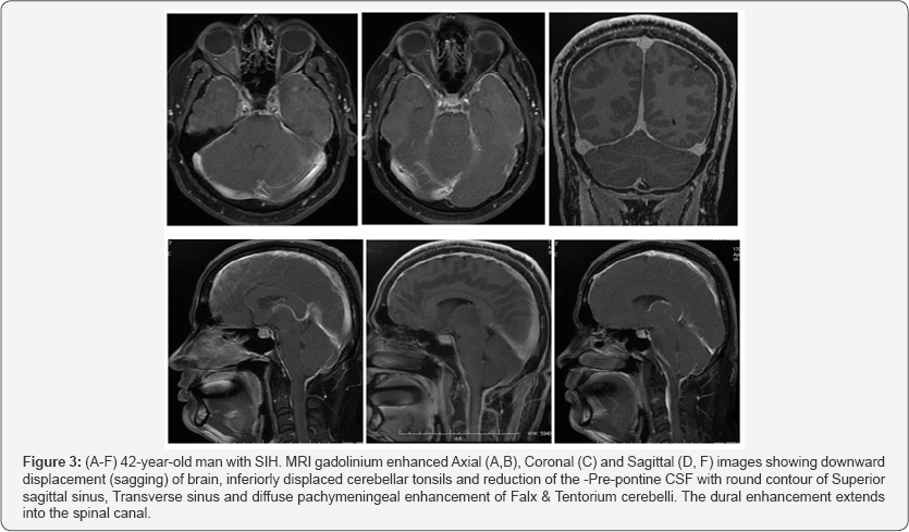 Click here to view Large Figure 3