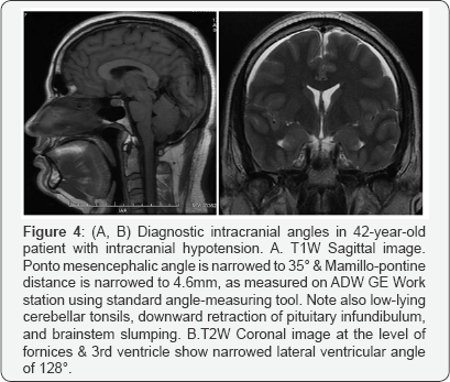 Click here to view Large Figure 4