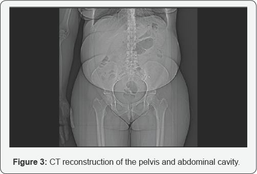 Click here to view Large Figure 3