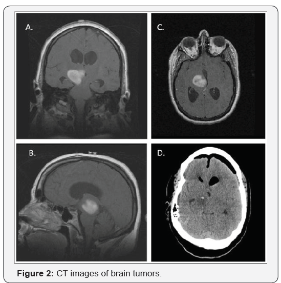 Click here to view Large Figure 2
