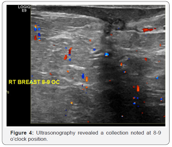 Click here to view Large Figure 4