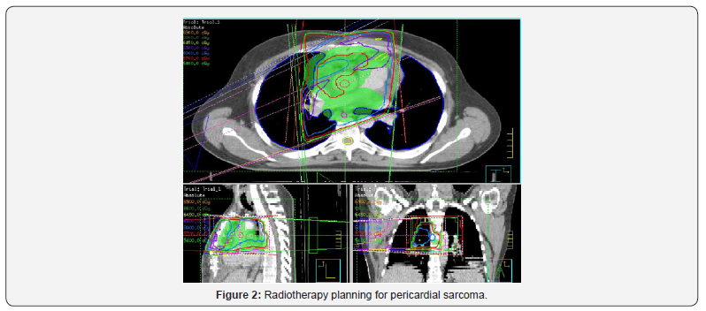 Click here to view Large Figure 2