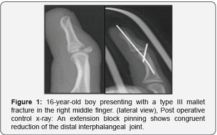 Click here to view Large
Figure 1