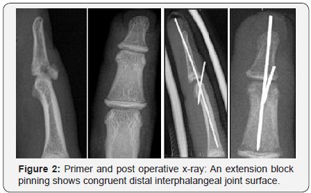 Click here to view Large Figure 2