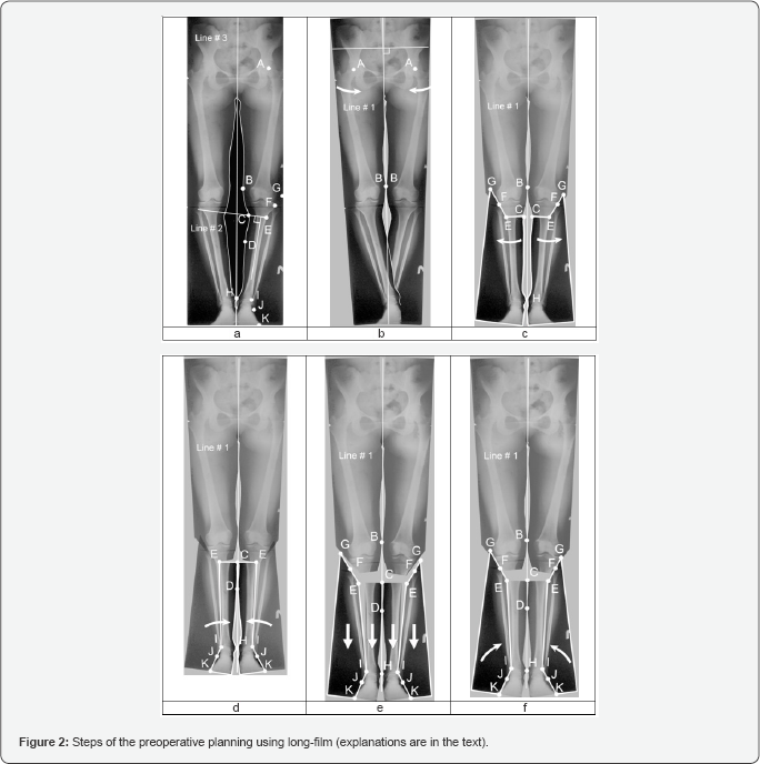 Click here to view Large Figure 2