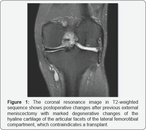 Click here to view Large Figure 1