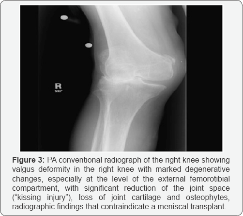 Click here to view Large Figure 3