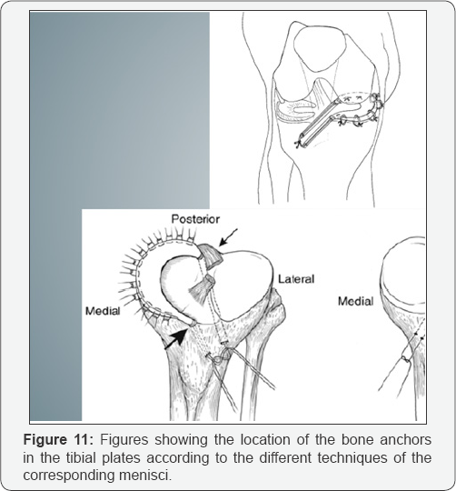 Click here to view Large Figure 11