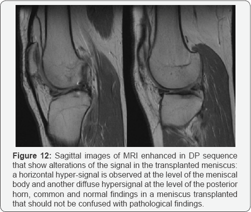 Click here to view Large Figure 12