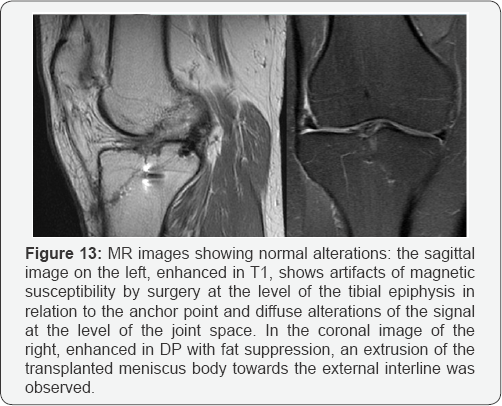 Click here to view Large Figure 13
