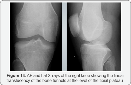 Click here to view Large Figure 14